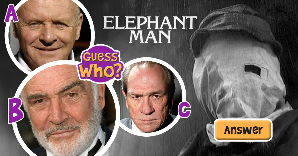 Guess Which One of These Actors Starred in The Hit Movie “The Elephant Man”?