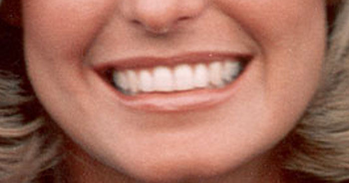 Can You Name the 1970’s Actress? Our Lips are Sealed.