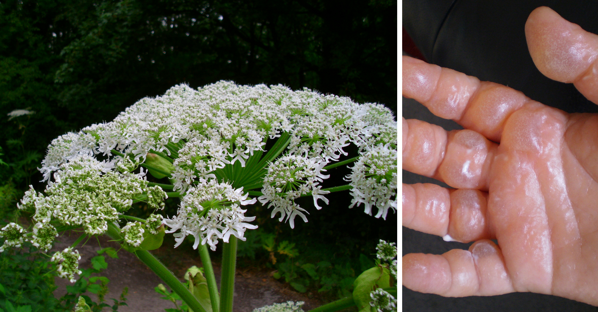 giant-hogweed