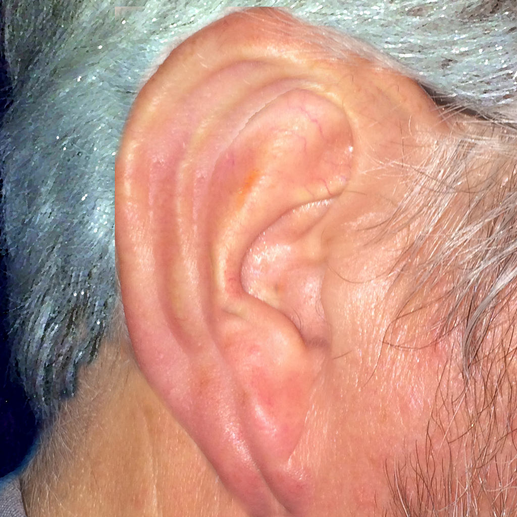 older ear