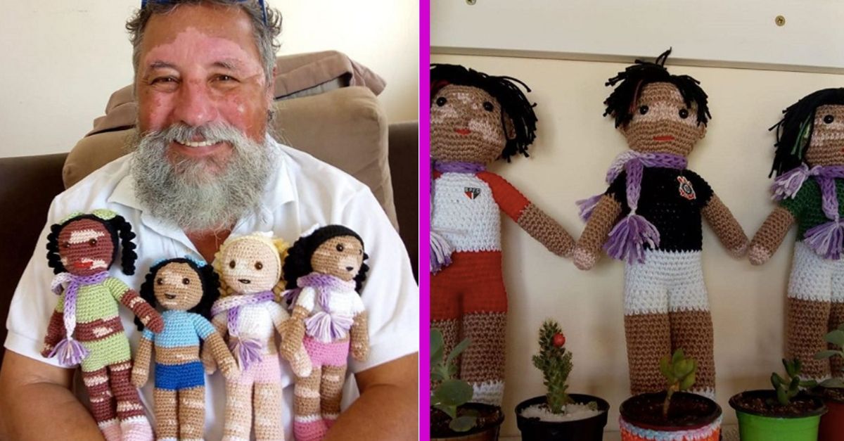 Grandfather With Vitiligo Knits Dolls For Children With The Same Disease