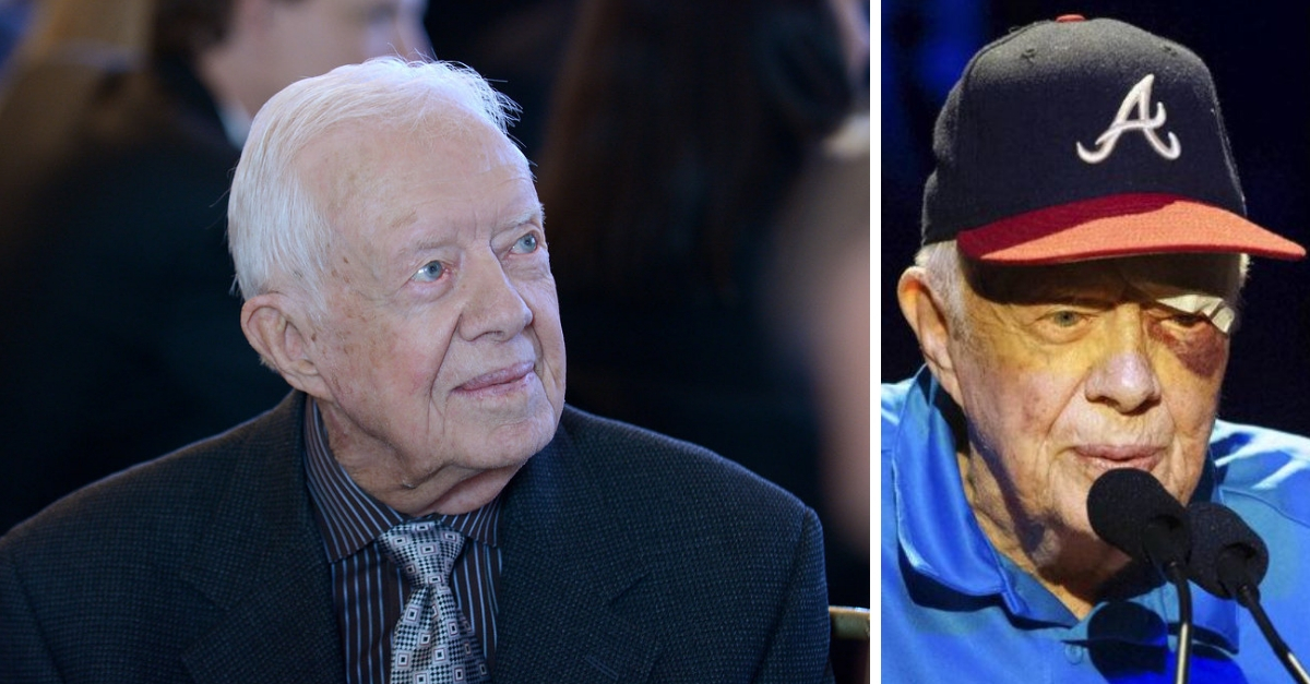 Jimmy Carter suffers black eye and stitches after fall at home